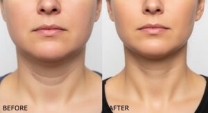 whisk 5b079cab3aed6b1bf3e4567782912bbbdr.jpeg